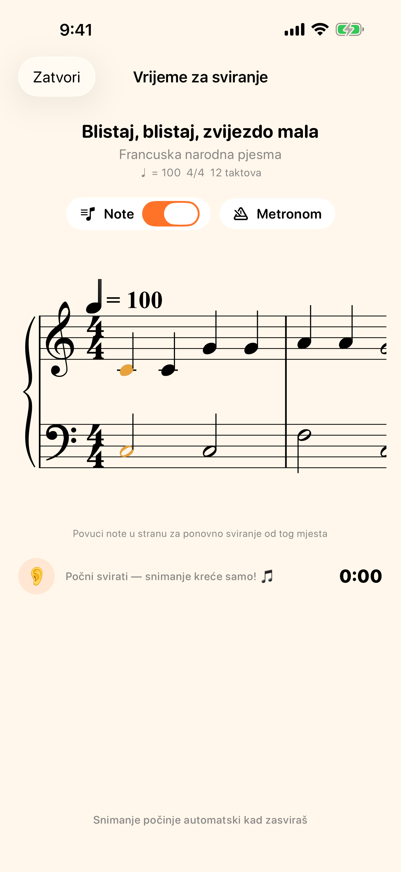 Note prate tvoje sviranje